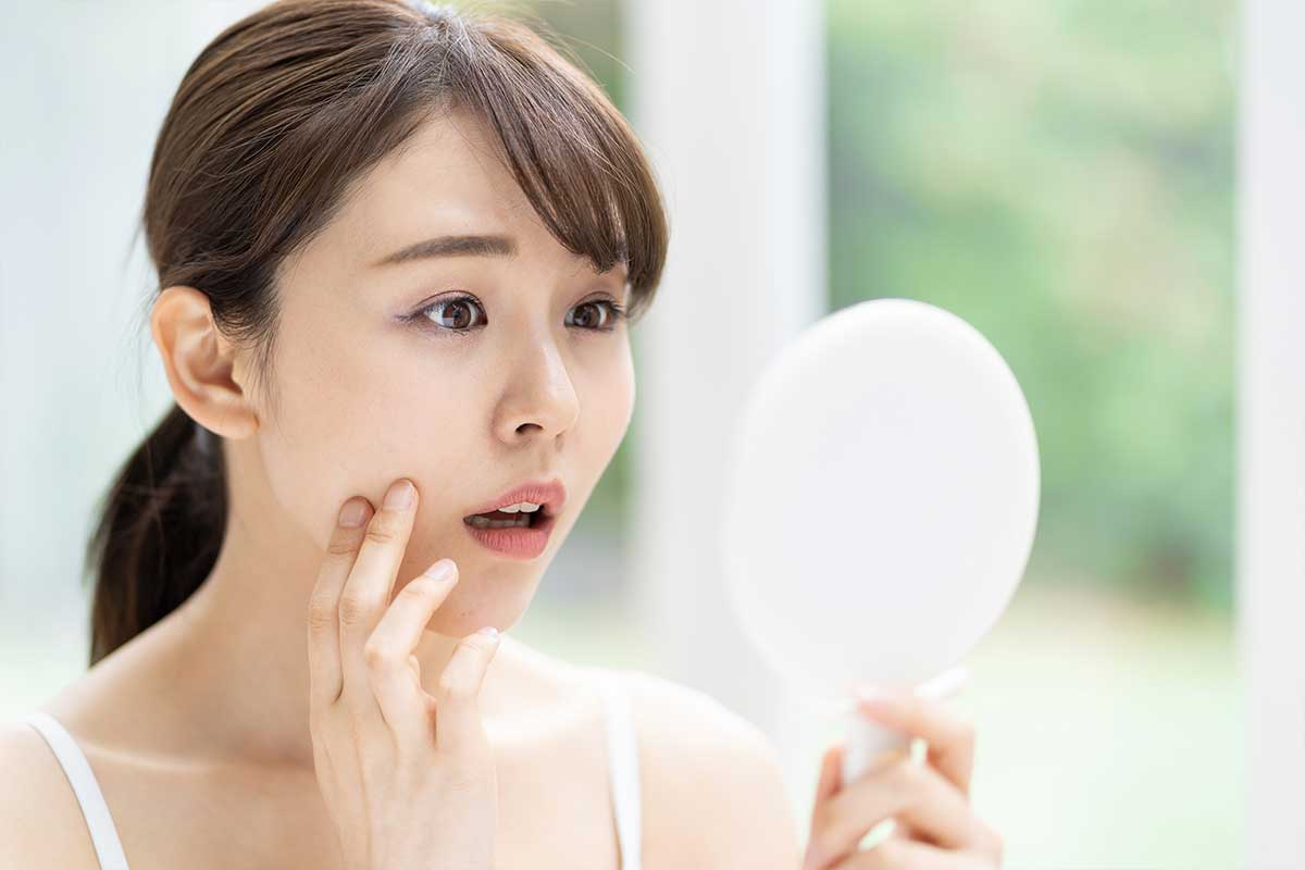 化粧水選びが美肌づくりの第一歩｜水分不足と肌トラブルの関係のイメージ